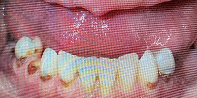 priestriverdental.com | Dental Implants