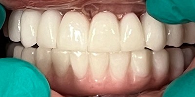 priestriverdental.com | Dental Implants