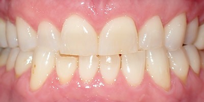priestriverdental.com | Dental Implants