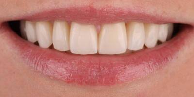 priestriverdental.com | Smile Gallery