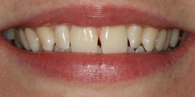 priestriverdental.com | Smile Gallery