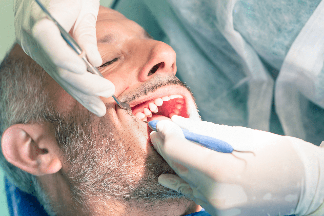 priestriverdental.com | When Is a Tooth Extraction Necessary? Signs, Procedure, and Recovery