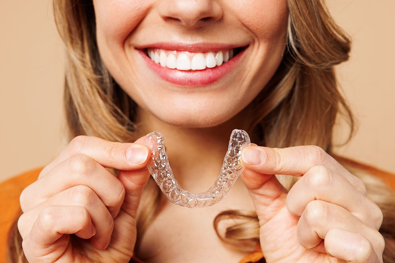 Clear Aligners: A Simple, Flexible Way to Straighten Teeth