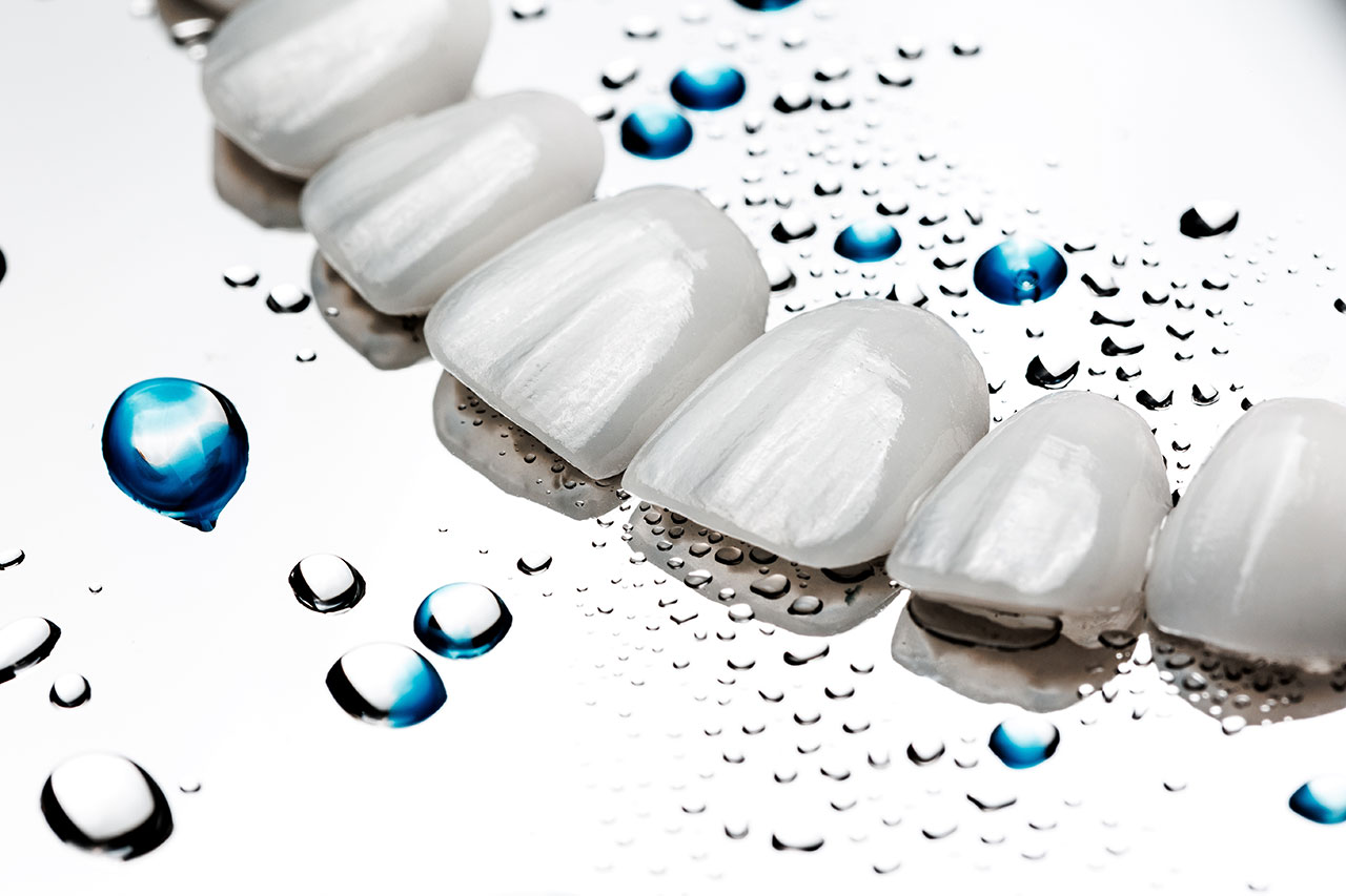 priestriverdental.com | Veneers: A Simple Way To Refresh Your Smile Without Overcomplicating It