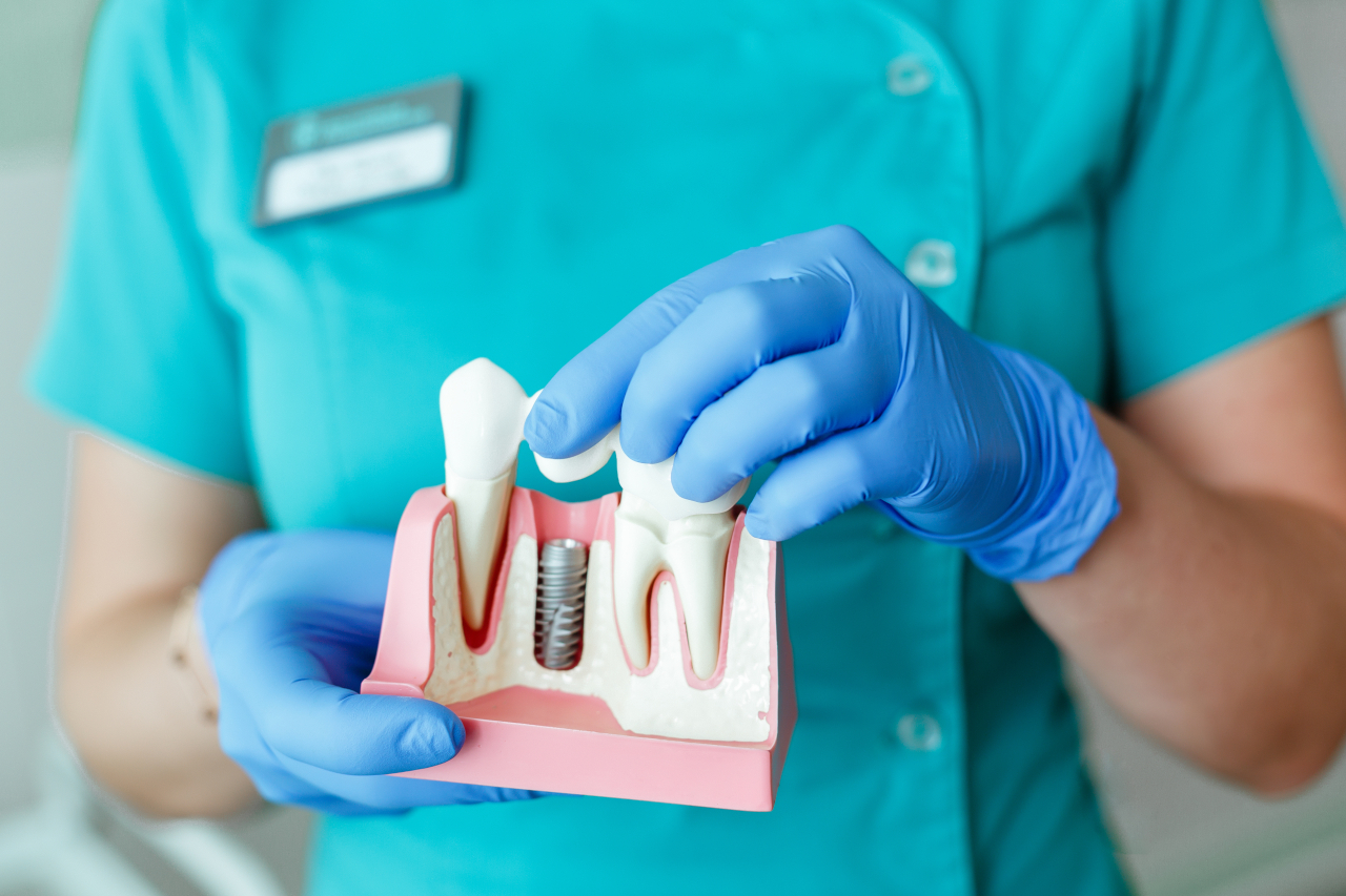 priestriverdental.com | What Happens If You Delay Replacing a Missing Tooth?